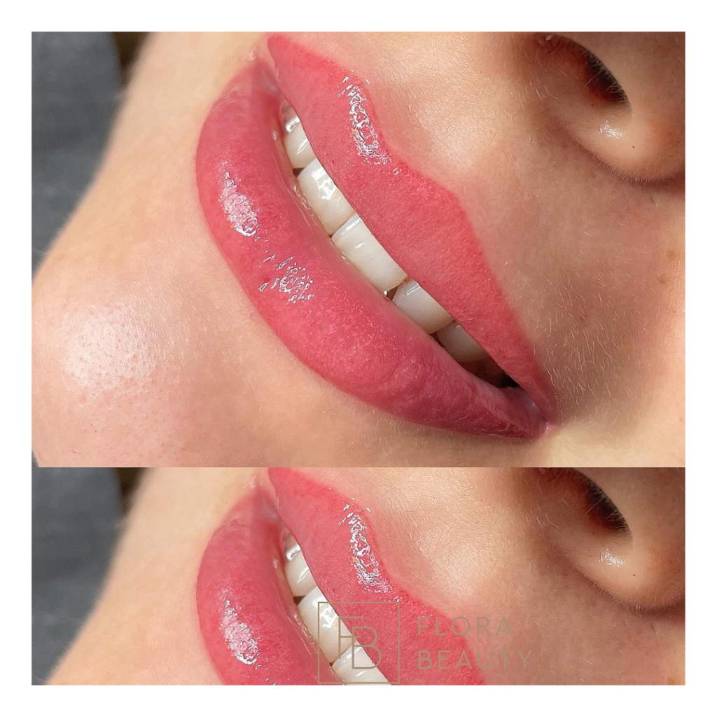 Lippenpigmentierung – FLORA BEAUTY